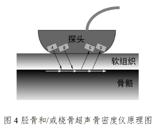 超聲骨密度儀注冊(cè)技術(shù)審查指導(dǎo)原則（2017年第180號(hào)）(圖4)