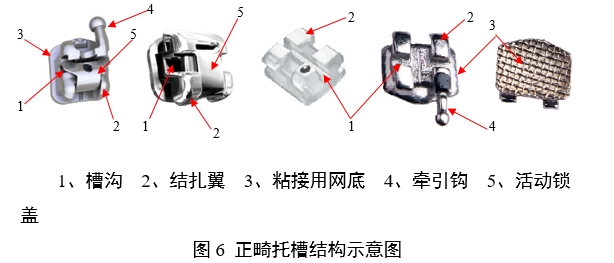 正畸托槽注冊(cè)審查指導(dǎo)原則（2022年第41號(hào)）(圖6)